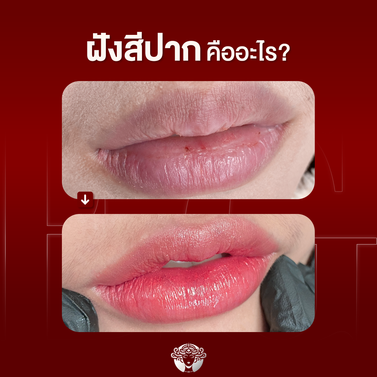 ฝังสีปาก